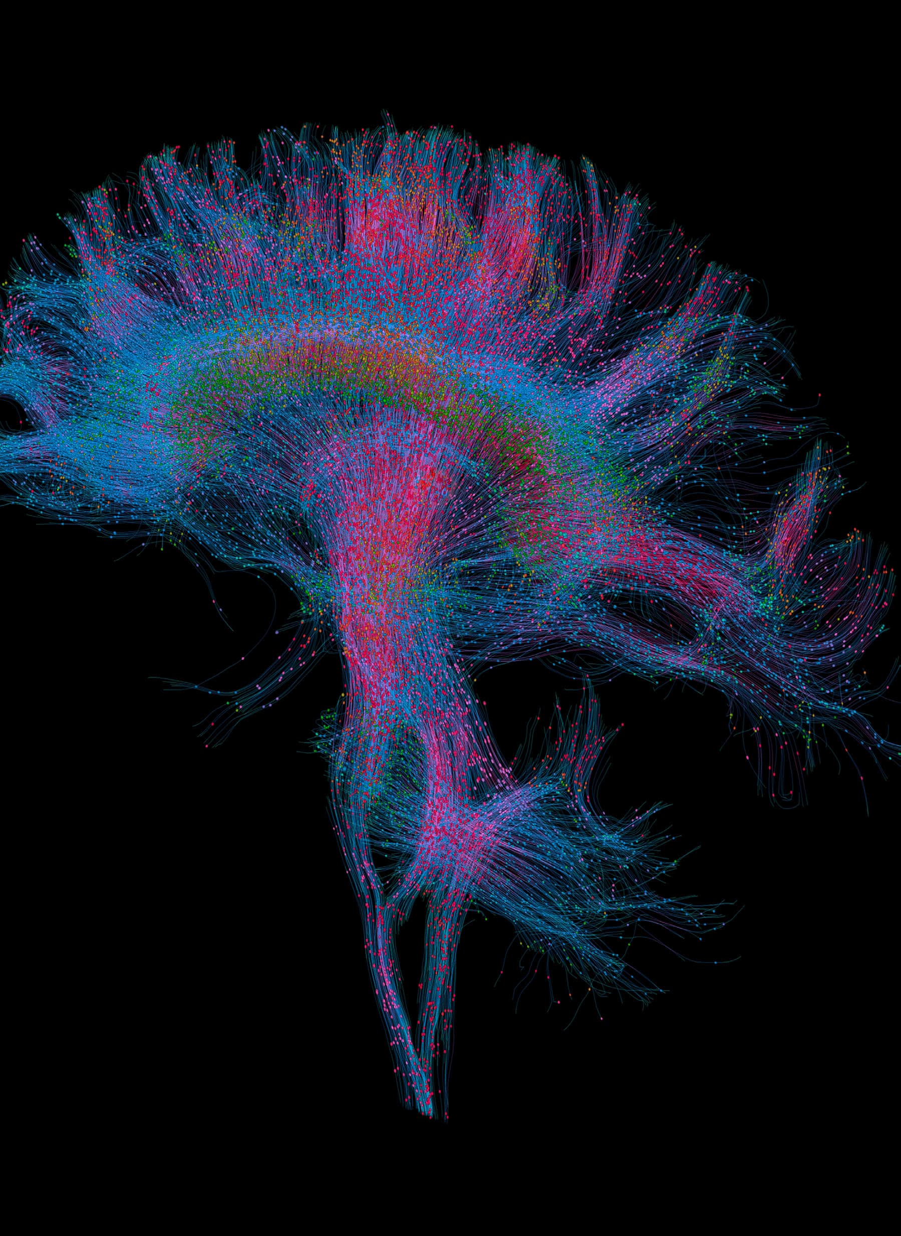 Plastic fantastic - neuron network visualisation